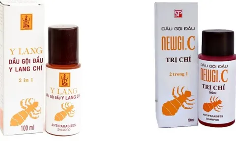 Siết hậu kiểm, cảnh báo nguy cơ mỹ phẩm gây hại cho người dùng
